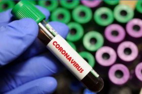 В США начали клинические испытания препарата от коронавируса